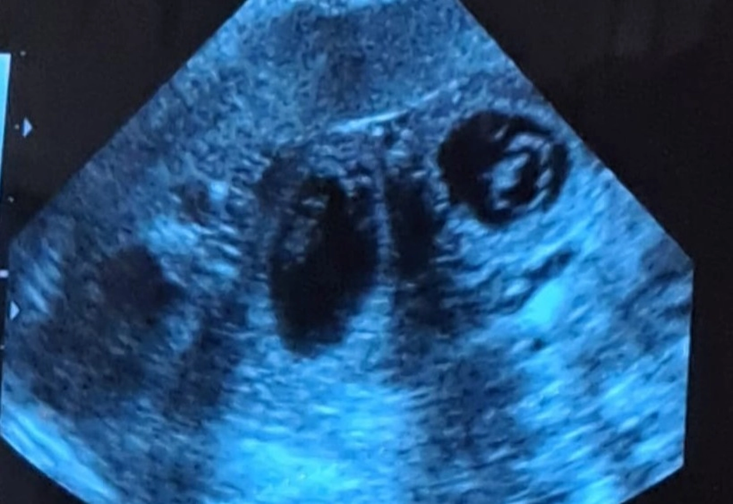 Malinois de la Frisone Liberte - Hundezucht - Ultraschallbericht eines Hundes